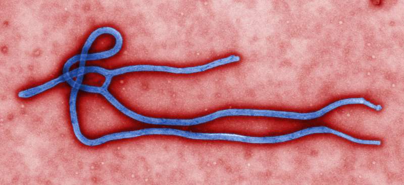 A colorized transmission electron micrograph of an Ebola virus virion.