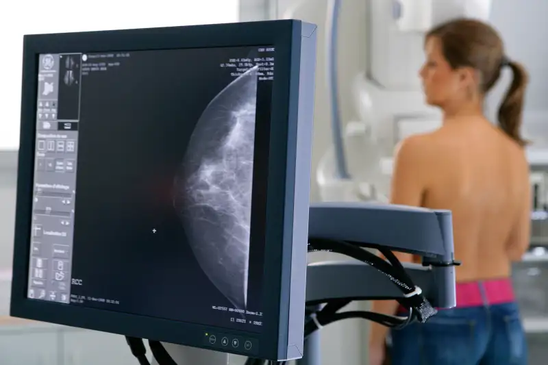 Women gets a mammogram.