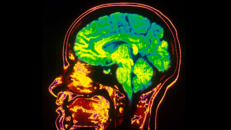 colorized brain MRI