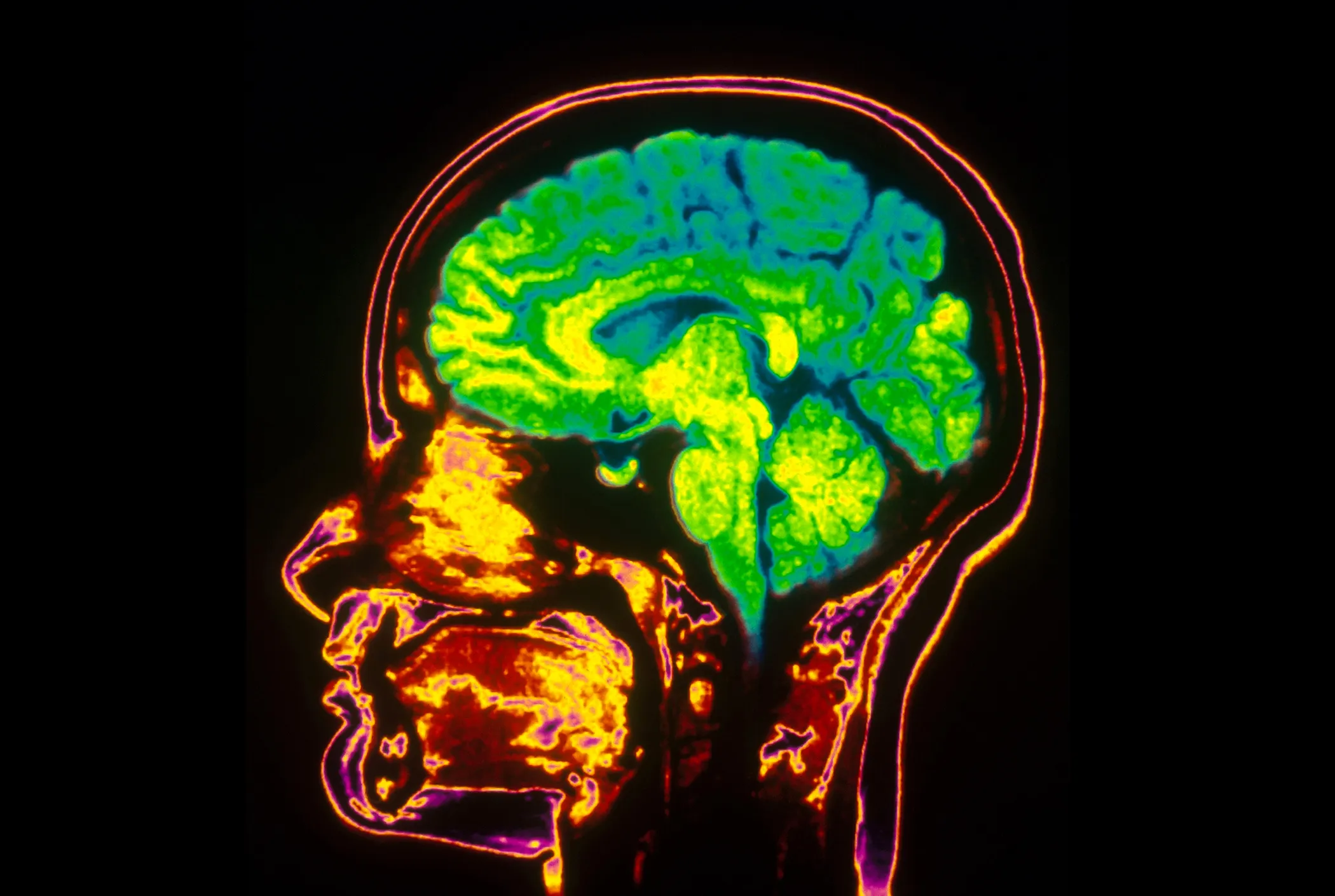 Your Brain Does Really Weird Stuff When It Thinks About Money