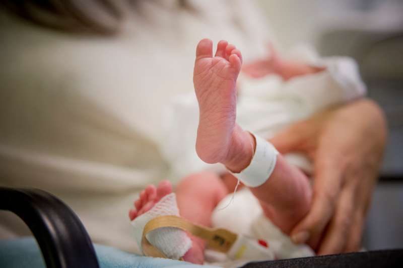Premature newborn leg
