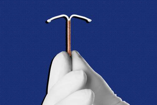 How to Get an IUD — Even if You Don't Have Insurance