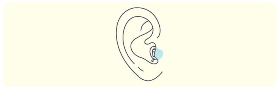 Illustration of completely-in-the-canal hearing aid