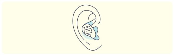 Illustration of in-the-ear hearing aid