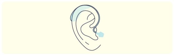 Illustration of receiver-in-canal hearing aid