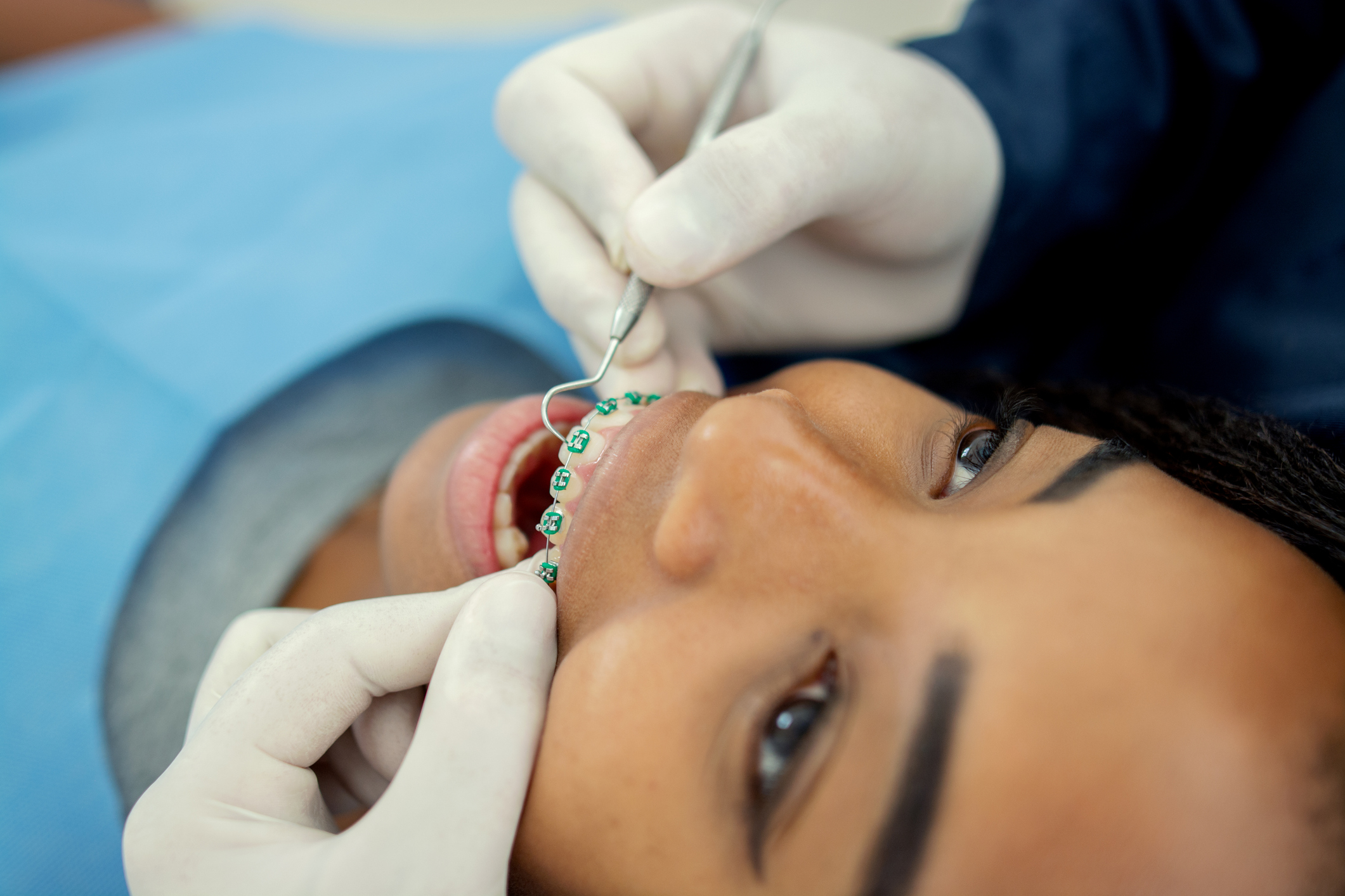How to Hire Orthodontists